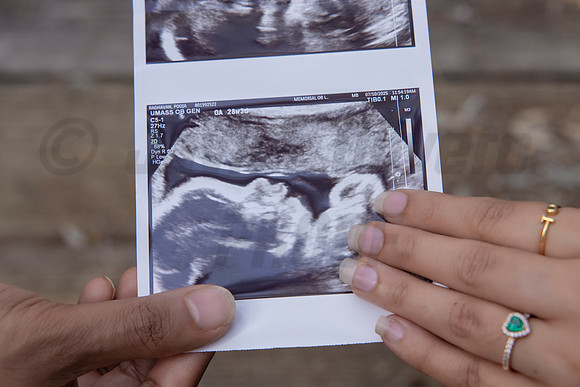 205-Pooja Maternity